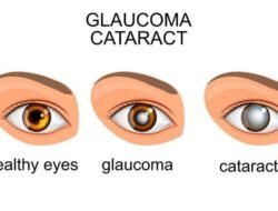Perbedaan Glaukoma dan Katarak Penyebab Hilangnya Penglihatan